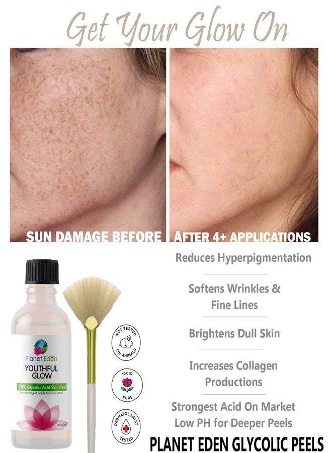 Planet Eden 70% Glycolic Acid Chemical Skin Peel Kit + Organic Botanical Peel Neutralizer and 1 oz Antioxidant Recovery Cream + Treatment Fan Brush - Image 2